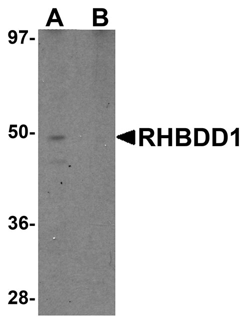 1 - RHBDD1 Antibody ASC11032