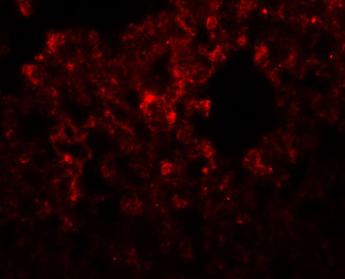3 - RHBDD3 Antibody ASC11034