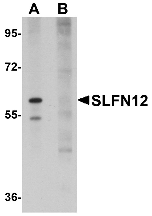 1 - SLFN12 Antibody ASC11036