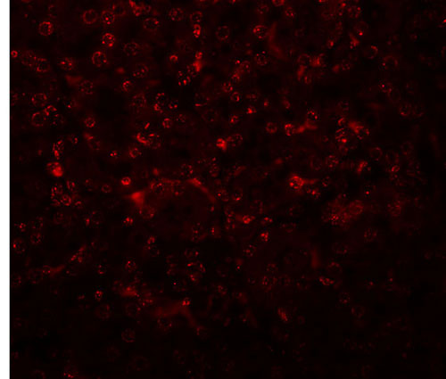 3 - SLFN14 Antibody ASC11037