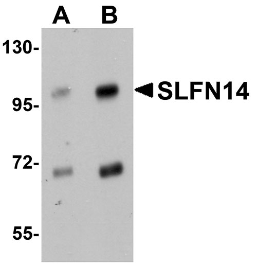 1 - SLFN14 Antibody ASC11037