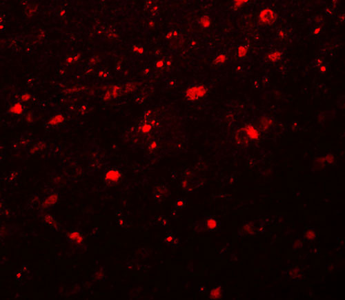 3 - Girdin Antibody ASC11038