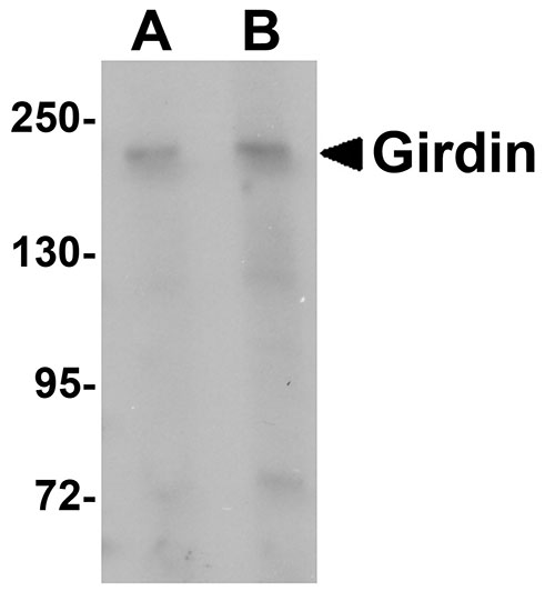 1 - Girdin Antibody ASC11038
