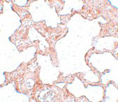 2 - VLK Antibody ASC11045