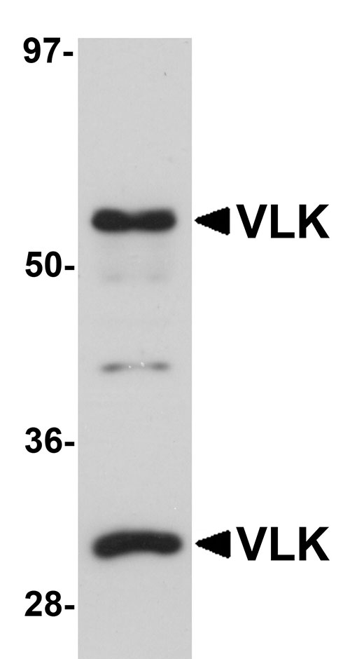 1 - VLK Antibody ASC11045