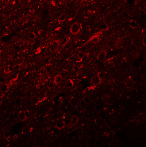 3 - SYNGR2 Antibody ASC11047