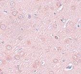 2 - SYNGR2 Antibody ASC11047
