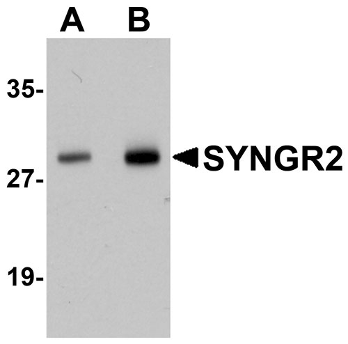 1 - SYNGR2 Antibody ASC11047