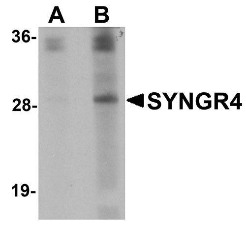 1 - SYNGR4 Antibody ASC11049