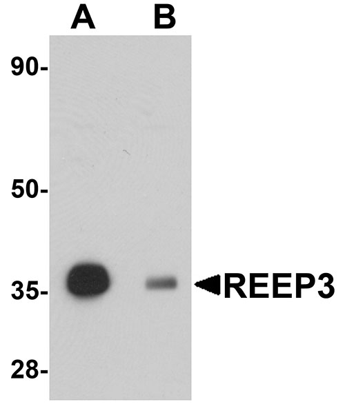 1 - REEP3 Antibody ASC11051