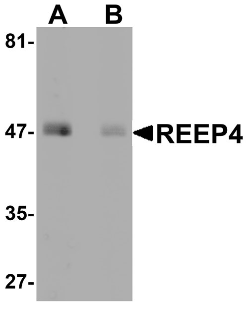 1 - REEP4 Antibody ASC11052