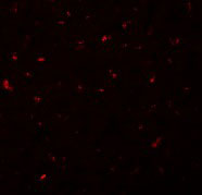 3 - CALHM1 Antibody ASC11061