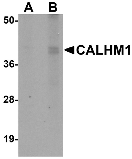 1 - CALHM1 Antibody ASC11061
