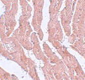 2 - LZTR1 Antibody ASC11073