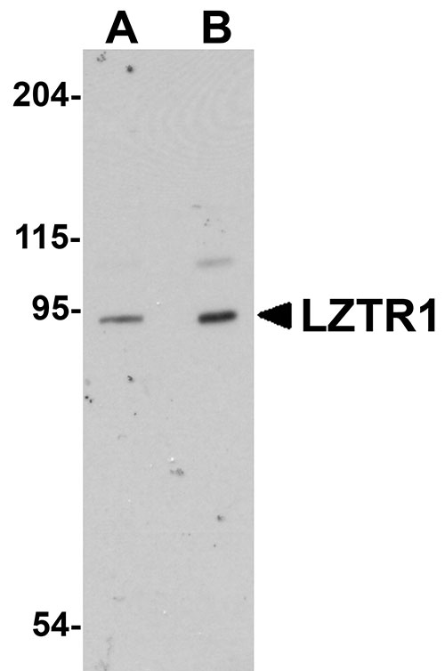 1 - LZTR1 Antibody ASC11073