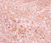 2 - LZTR2 Antibody ASC11074
