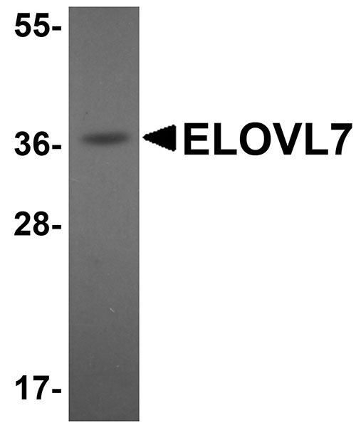 1 - ELOVL7 Antibody ASC11083