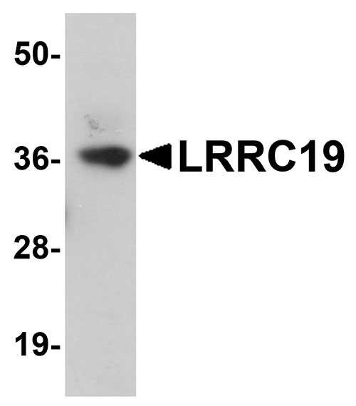 1 - LRRC19 Antibody ASC11084