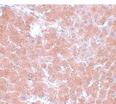 2 - TMEM70 Antibody ASC11085