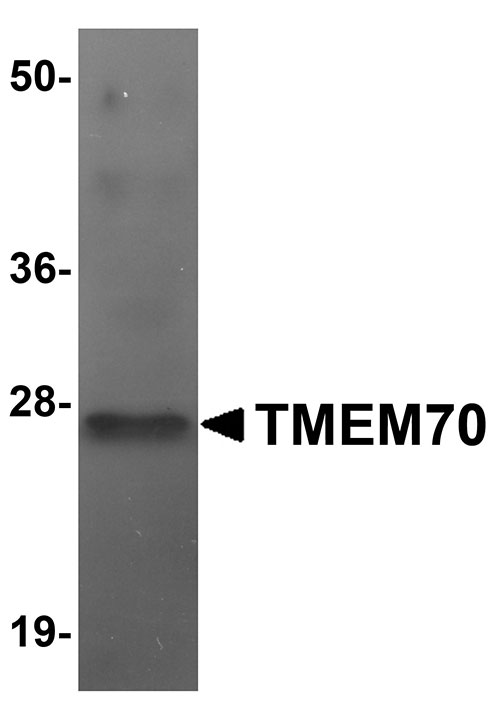 1 - TMEM70 Antibody ASC11085