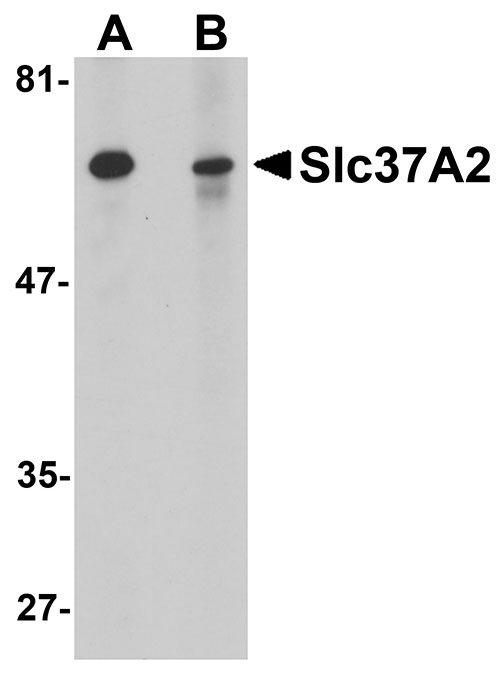 1 - Slc37A2 Antibody ASC11086