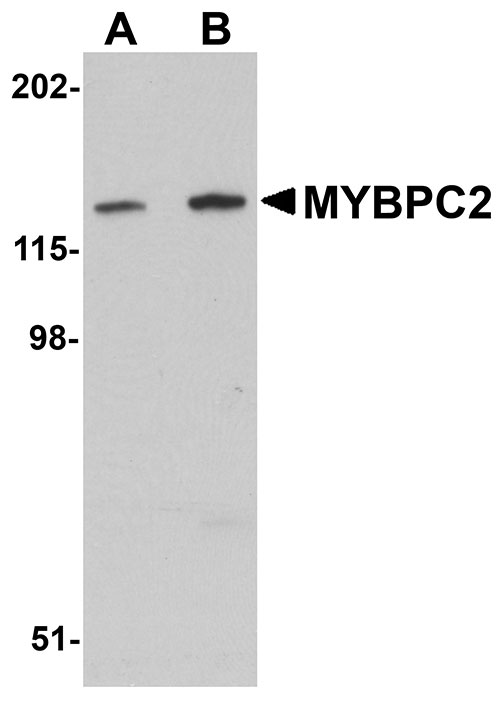 1 - MYBPC2 Antibody ASC11088