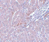 2 - LYRM1 Antibody ASC11091