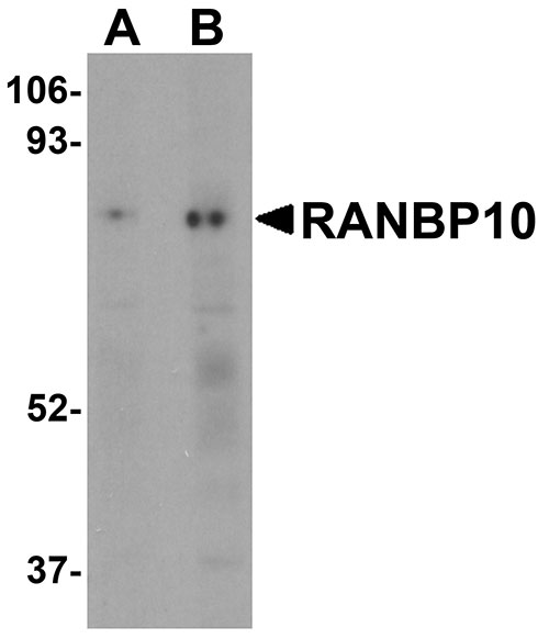 1 - RANBP10 Antibody ASC11094