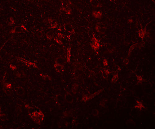 3 - ZC3H12C Antibody ASC11100