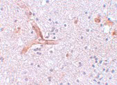 2 - ZC3H12C Antibody ASC11100