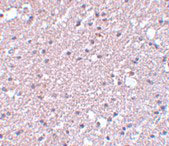 2 - TMEM184A Antibody ASC11102