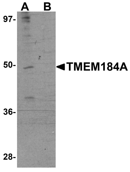 1 - TMEM184A Antibody ASC11102