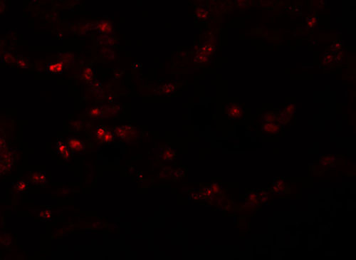 3 - TMEM184B Antibody ASC11103