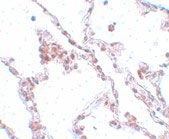 2 - TMEM184B Antibody ASC11103