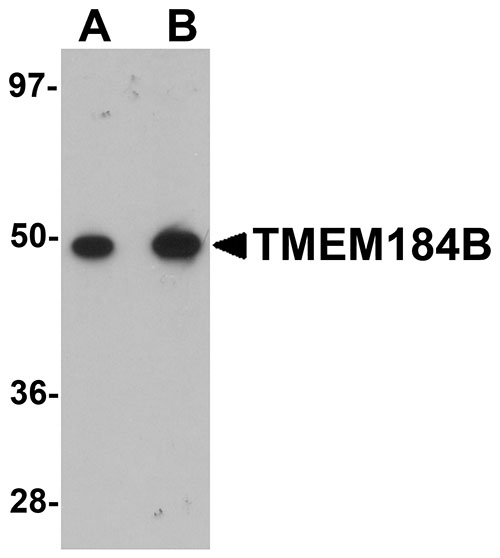 1 - TMEM184B Antibody ASC11103