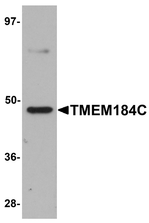 1 - TMEM184C Antibody ASC11104