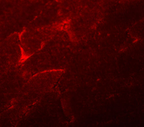 3 - ADAMTSL5 Antibody ASC11105