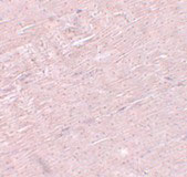 2 - ADAMTSL5 Antibody ASC11105