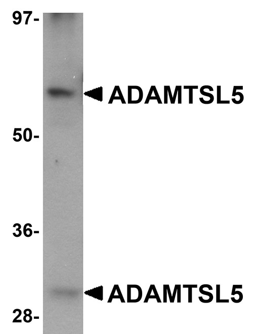 1 - ADAMTSL5 Antibody ASC11105