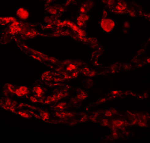 3 - CCDC69 Antibody ASC11106