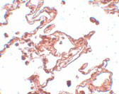 2 - CCDC69 Antibody ASC11106