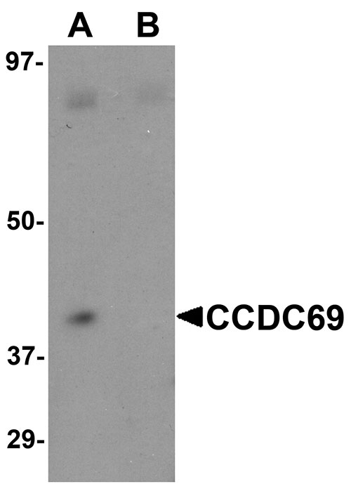 1 - CCDC69 Antibody ASC11106