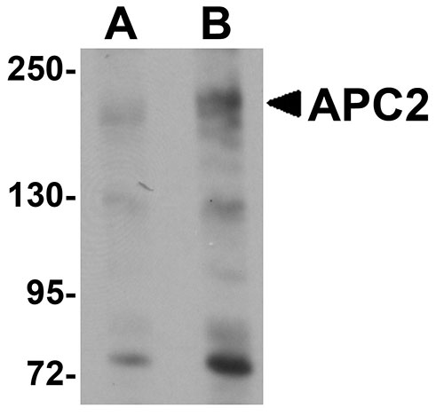 1 - APC2 Antibody ASC11114