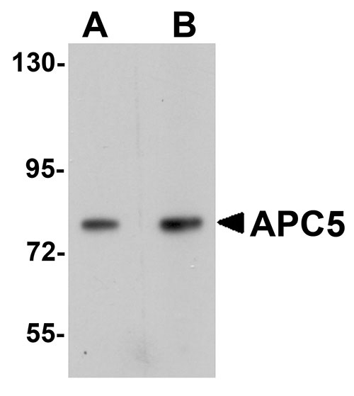 1 - APC5 Antibody ASC11117