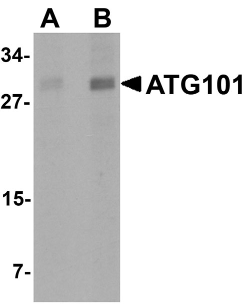 1 - ATG101 Antibody ASC11146