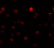3 - ZEB1 Antibody ASC11157