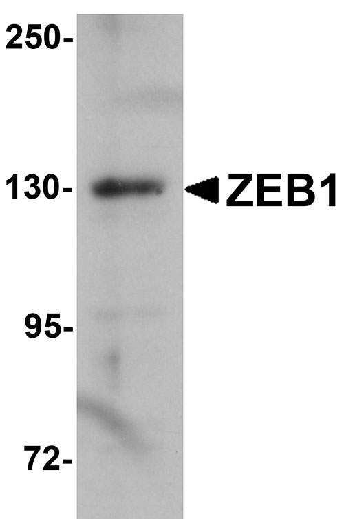 1 - ZEB1 Antibody ASC11157