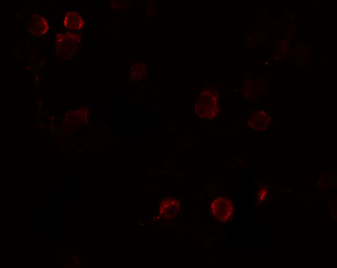3 - FREM1 Antibody ASC11159