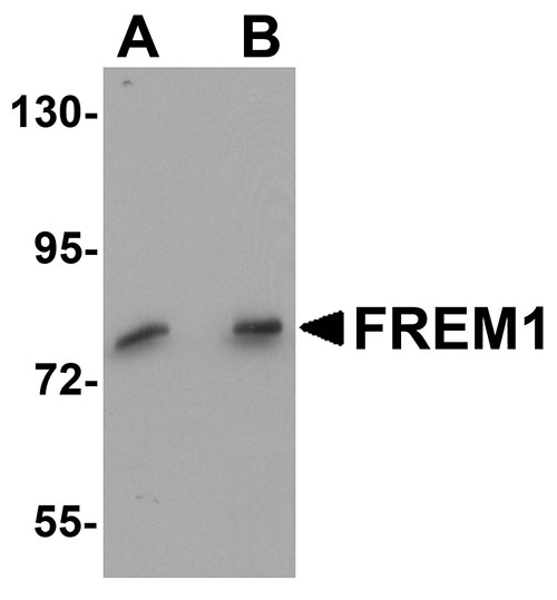 1 - FREM1 Antibody ASC11159