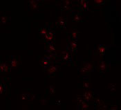 3 - FREM2 Antibody ASC11160